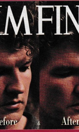 Before & After:Tim Finn