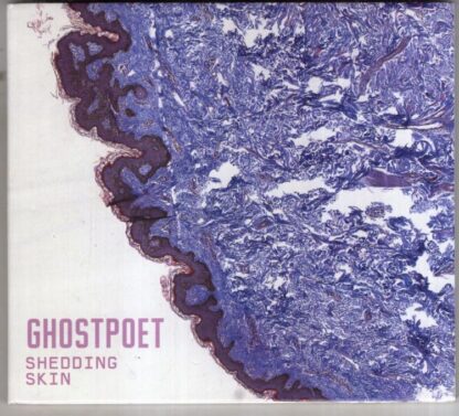 Shedding Skin:Ghostpoet