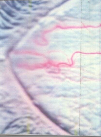 SCLEROLOGY—A New View Of An Ancient Art : Leonard Mehlmauer - Image 2