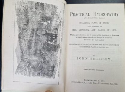 Practical Hydropathy : John Smedley - Image 2