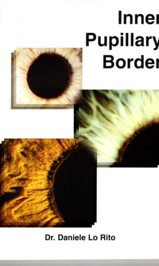 Inner Pupillary Border : Dr. Daniele Lo Rito