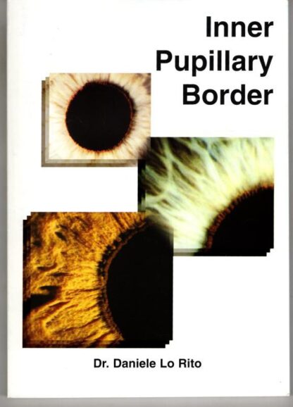 Inner Pupillary Border : Dr. Daniele Lo Rito